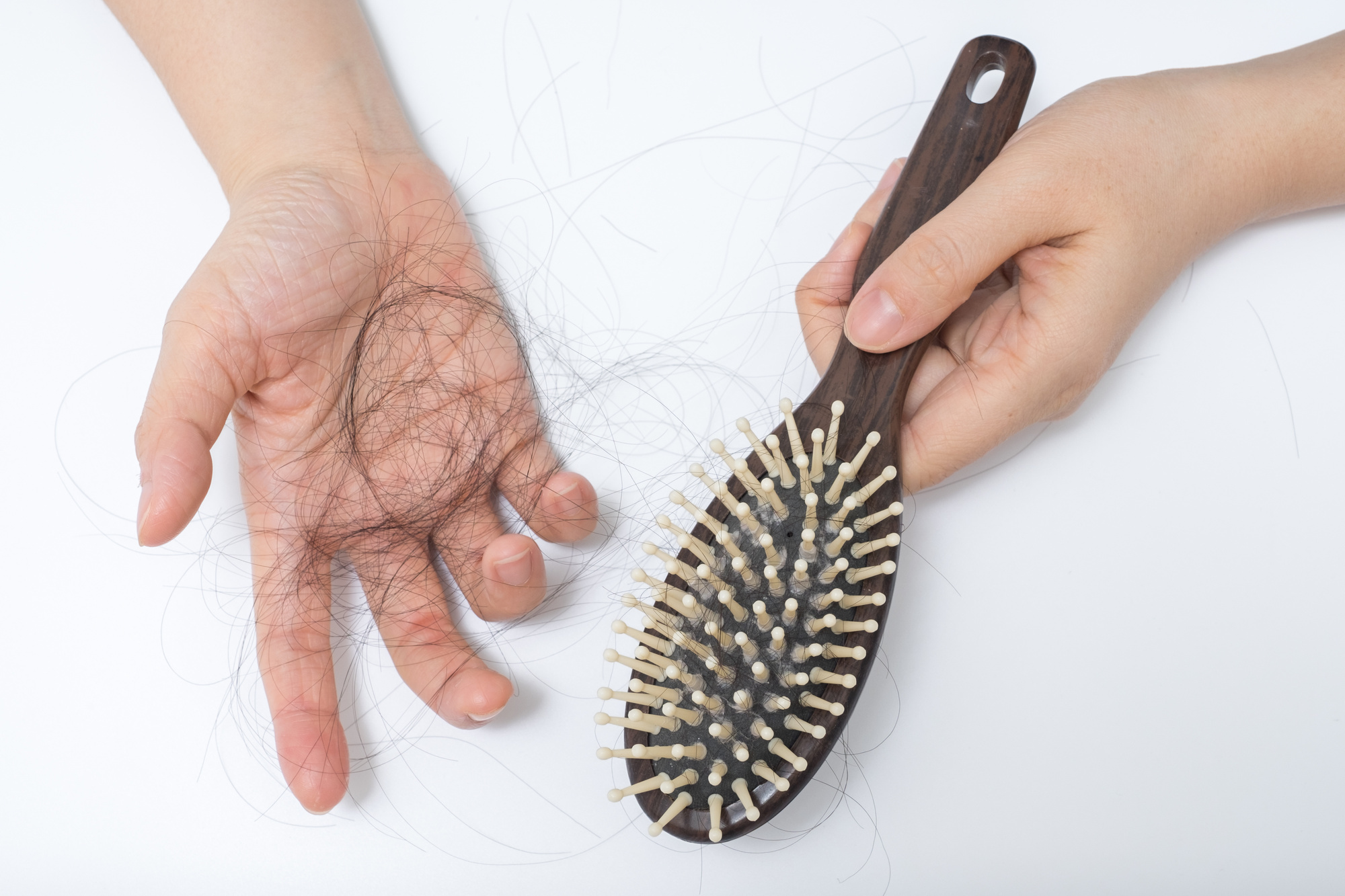 Female hair loss