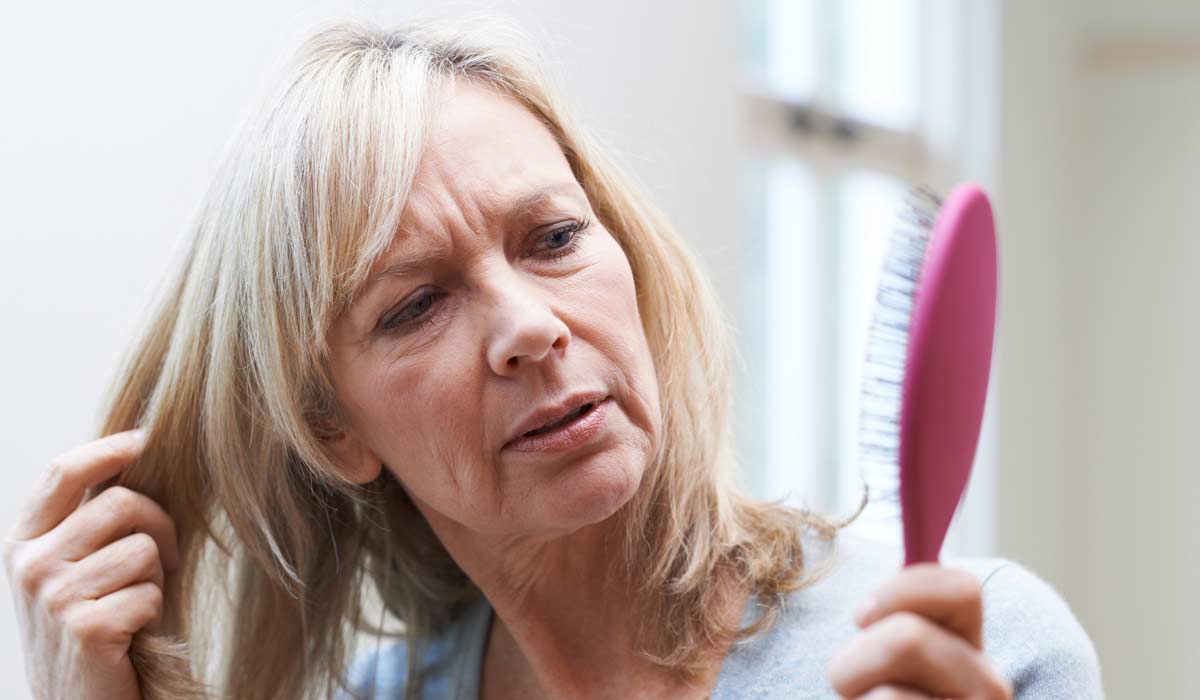 La-Menopausia-y-la-Alopecia-en-Mujeres-