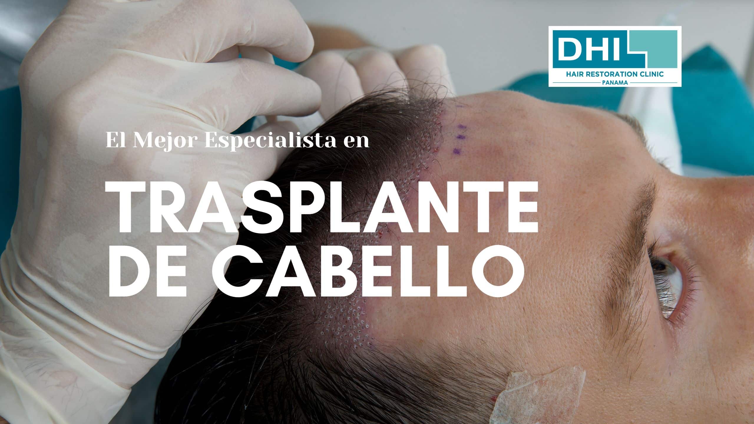 El Mejor Especialista en Trasplante de Cabello